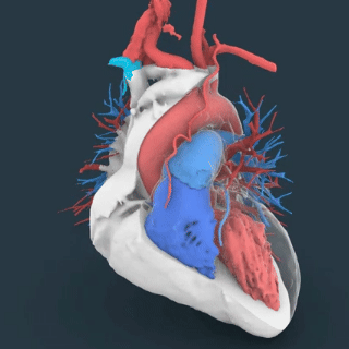 心肌旋切图片演示