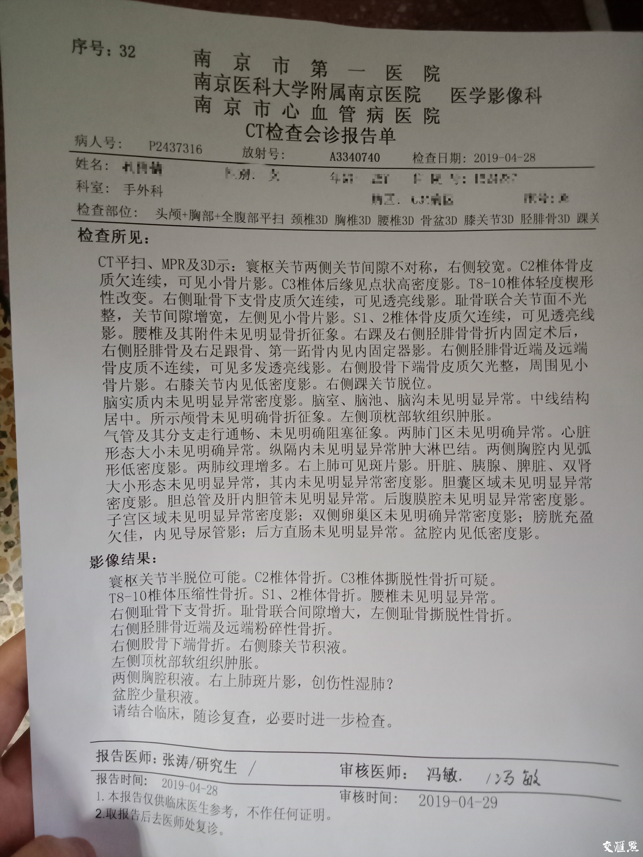 刘芳(化名)的CT会诊报告单。