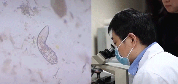 有个人脸上密密麻麻都是▼