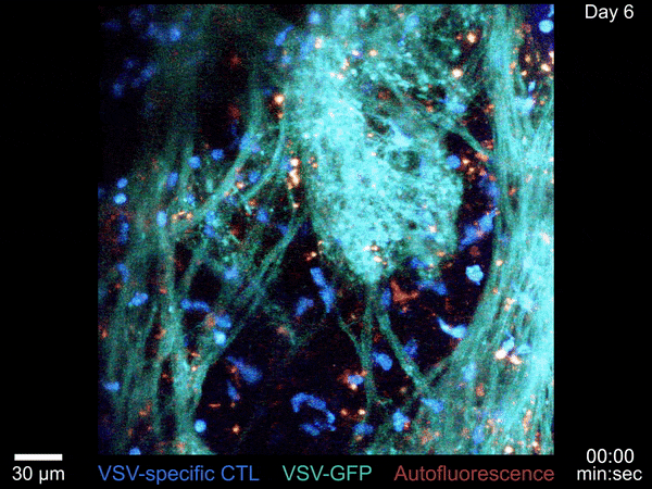 深藍色的細胞毒性淋巴細胞會在嗅球處尋找感染的痕迹