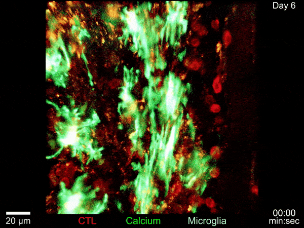 紅色的細胞毒性淋巴細胞在接觸到小膠質細胞後，鈣通量會發生變化（出現綠色）