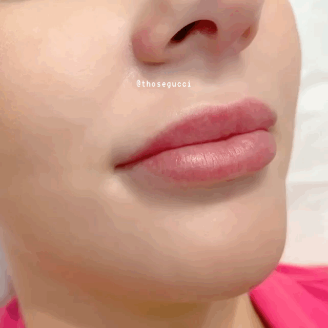 嘴巴自然上移,人中就会缩短,变成可爱美人~②比较省力气的是纹绣嘴唇