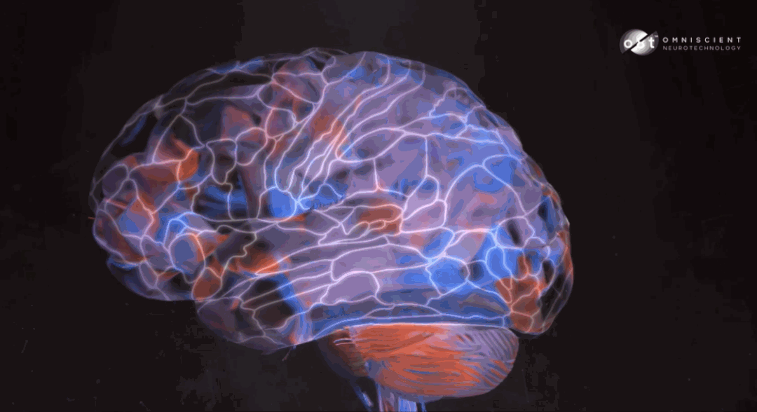 omniscient 方面人士在接受媒体采访时提到,公司的大脑图谱和连接