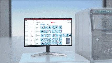 细胞制片夹怎么用Xpro 90｜样本进，结果出，属于病理科的流水线_https://www.jmylbn.com_新闻资讯_第3张